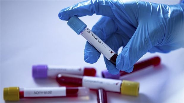 Azərbaycanda daha iki nəfər koronavirusdan öldü, 30 yeni yoluxma aşkarlandı - RƏSMİ