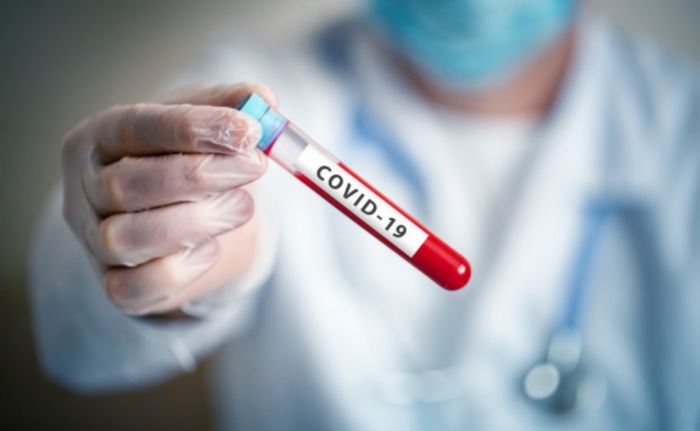 Son sutkada 27 nəfər koronavirusdan dünyasını dəyişdi