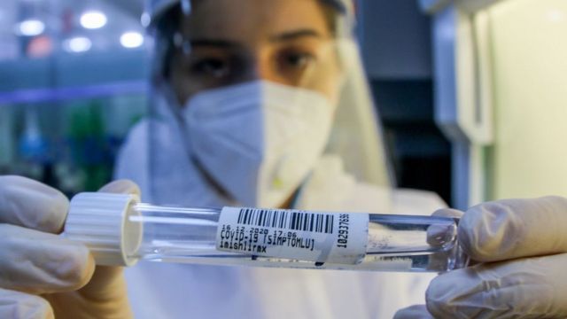 Çində son sutkada 37 milyon insan koronavirusa yoluxdu